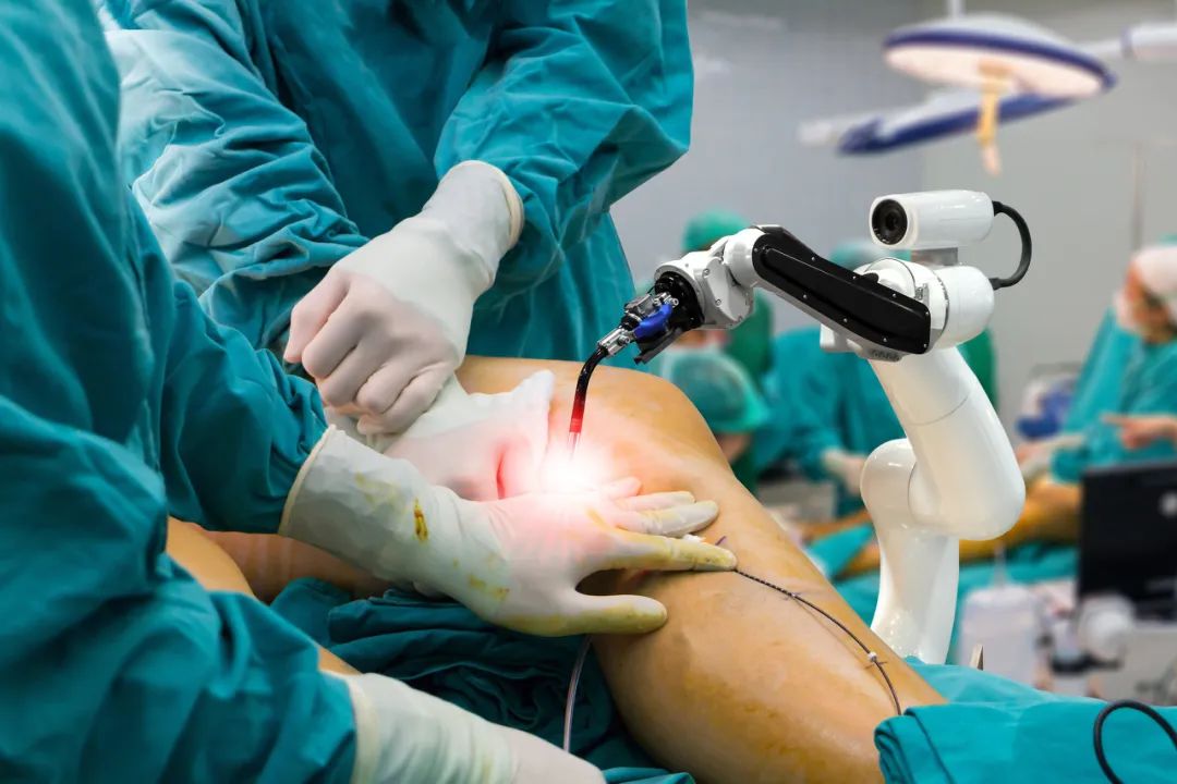 Robotic-Assisted Surgery