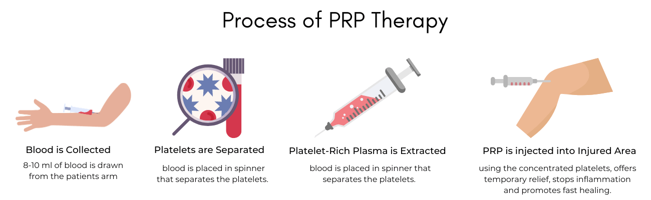 How PRP Works