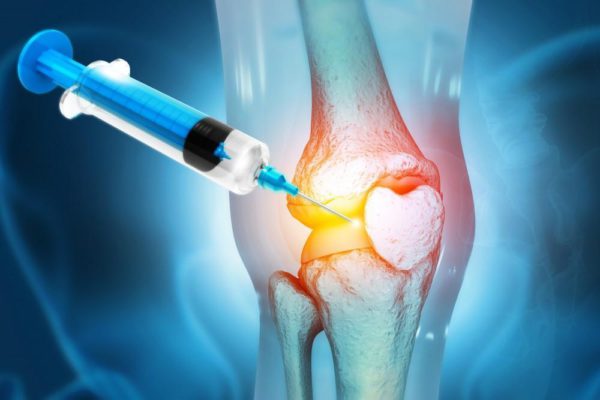 Benefits of PRP Therapy