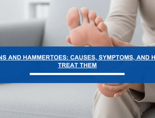 Bunions and Hammertoes: Causes, Symptoms, and How to Treat Them