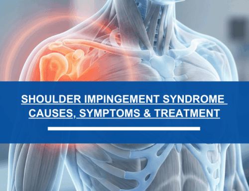 Shoulder Impingement Syndrome: Causes, Symptoms & Treatment