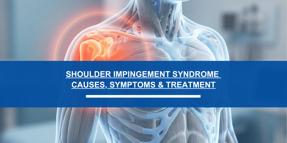 Shoulder Impingement Syndrome Causes, Symptoms & Treatment