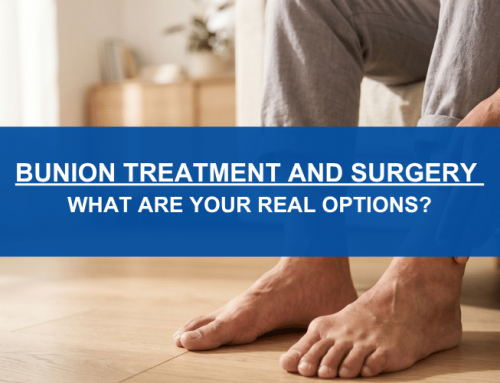 Bunion Treatment and Surgery: What Are Your Real Options?